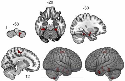Enhancing Brain Connectivity With Infra-Low Frequency Neurofeedback During Aging: A Pilot Study
